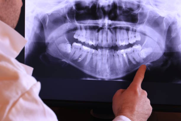Best Emergency Tooth Extraction in Waverly, MI