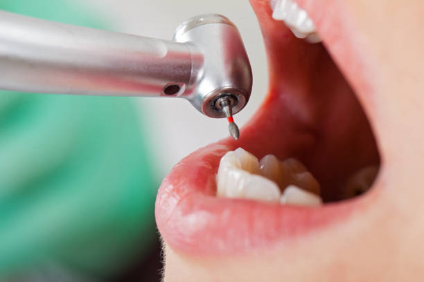 Best Emergency Treatment for Toothache in Waverly, MI